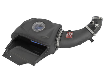 aFe Honda S2000 Takeda Momentum Cold Air Intake System - ML Performance US